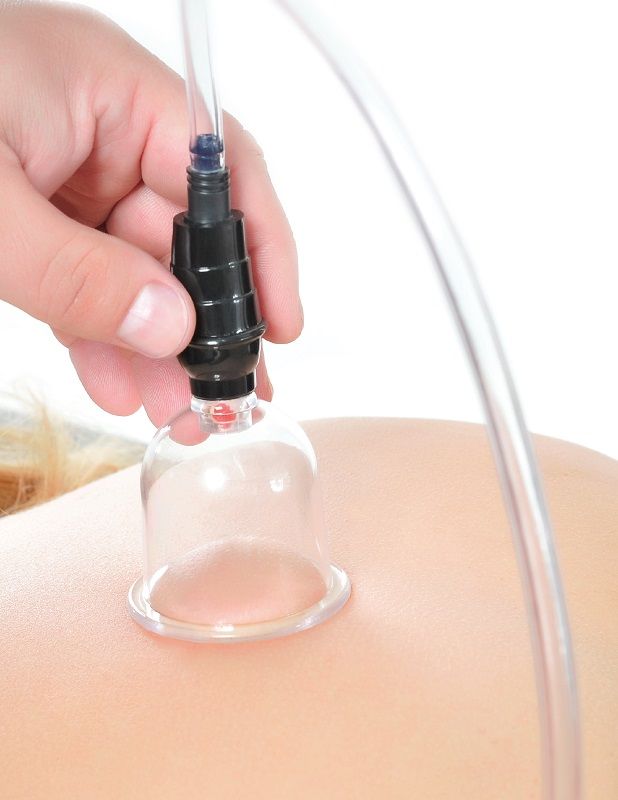 FETISH FANTASY SERIES - ENSEMBLE DE VENTOUSES 6 PIÈCES - 7eme ciel